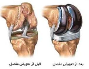 طراحي و ساخت اعضاء مورد نياز بدن انسان با كشت آزمايشگاهي و چابگر سه بعدي